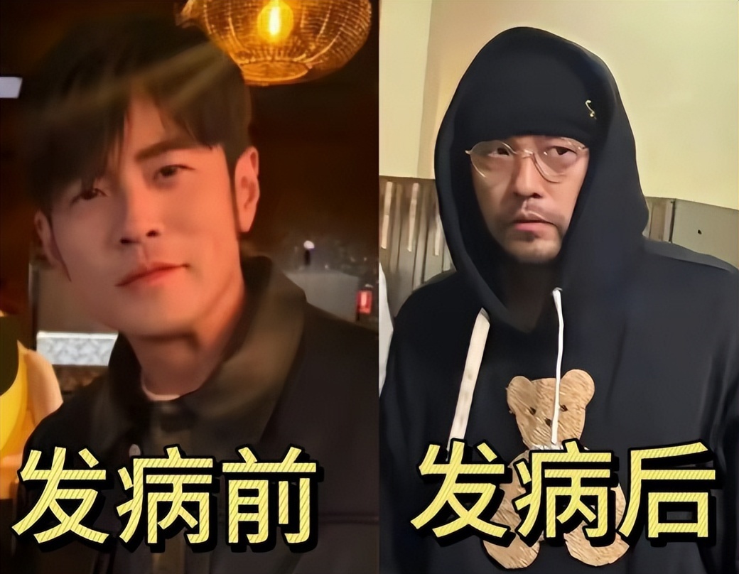 钱再多有什么用!46岁周杰伦现状曝光!病情严重到走路需要人搀扶 钱再多有什么用!46岁周杰伦现状曝光!病情严重到走路需要人搀扶